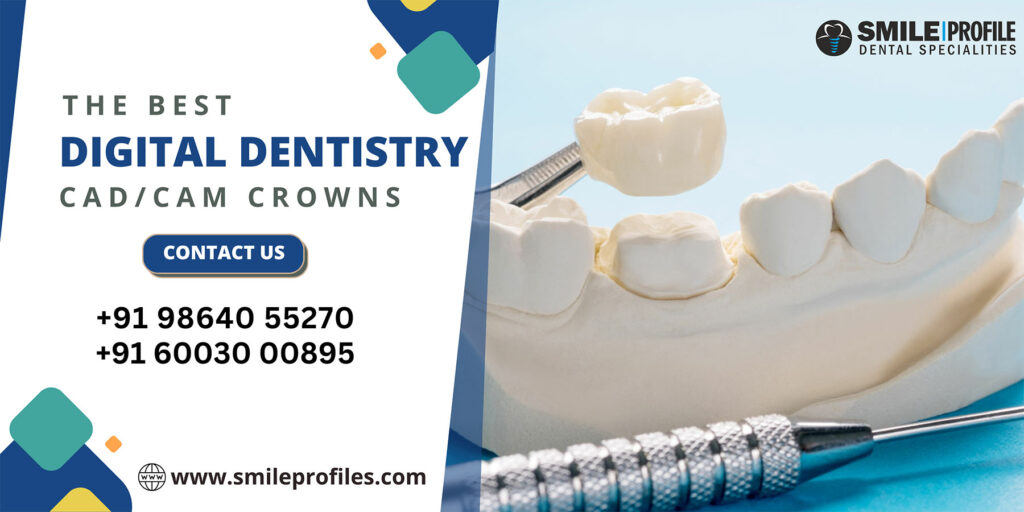 Digital DentistryCAD/CAM Crowns Smile Profile Dental Specialities